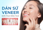 Tìm Hiêu Nên Chọn Bọc Răng Sứ Hay Mặt Dán Sứ Veneer 